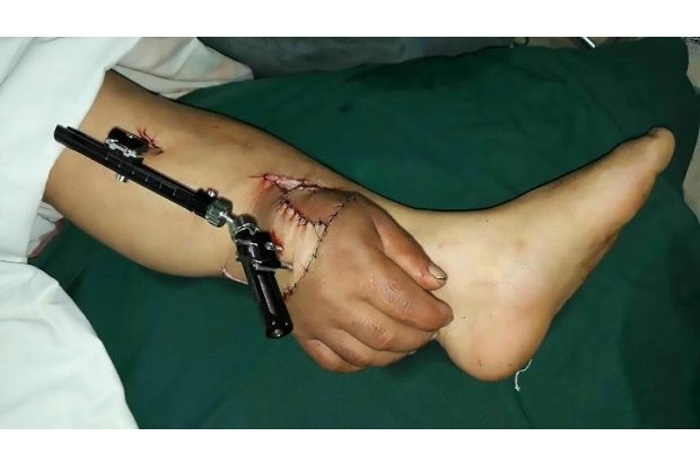 Cherry Crush порно